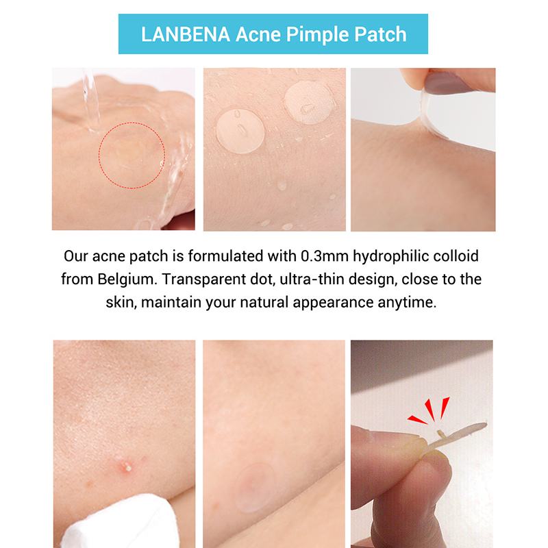 Tea Tree Acne Patch Image 1