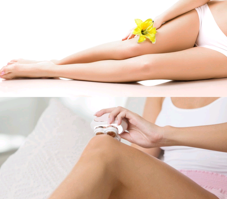 Four-Head Rotating Hair Removal Device Image 2