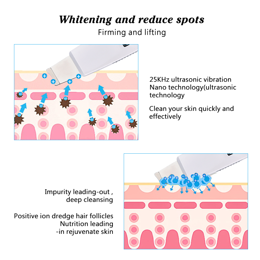 Ultrasonic Facial Cleansing Device Image 3
