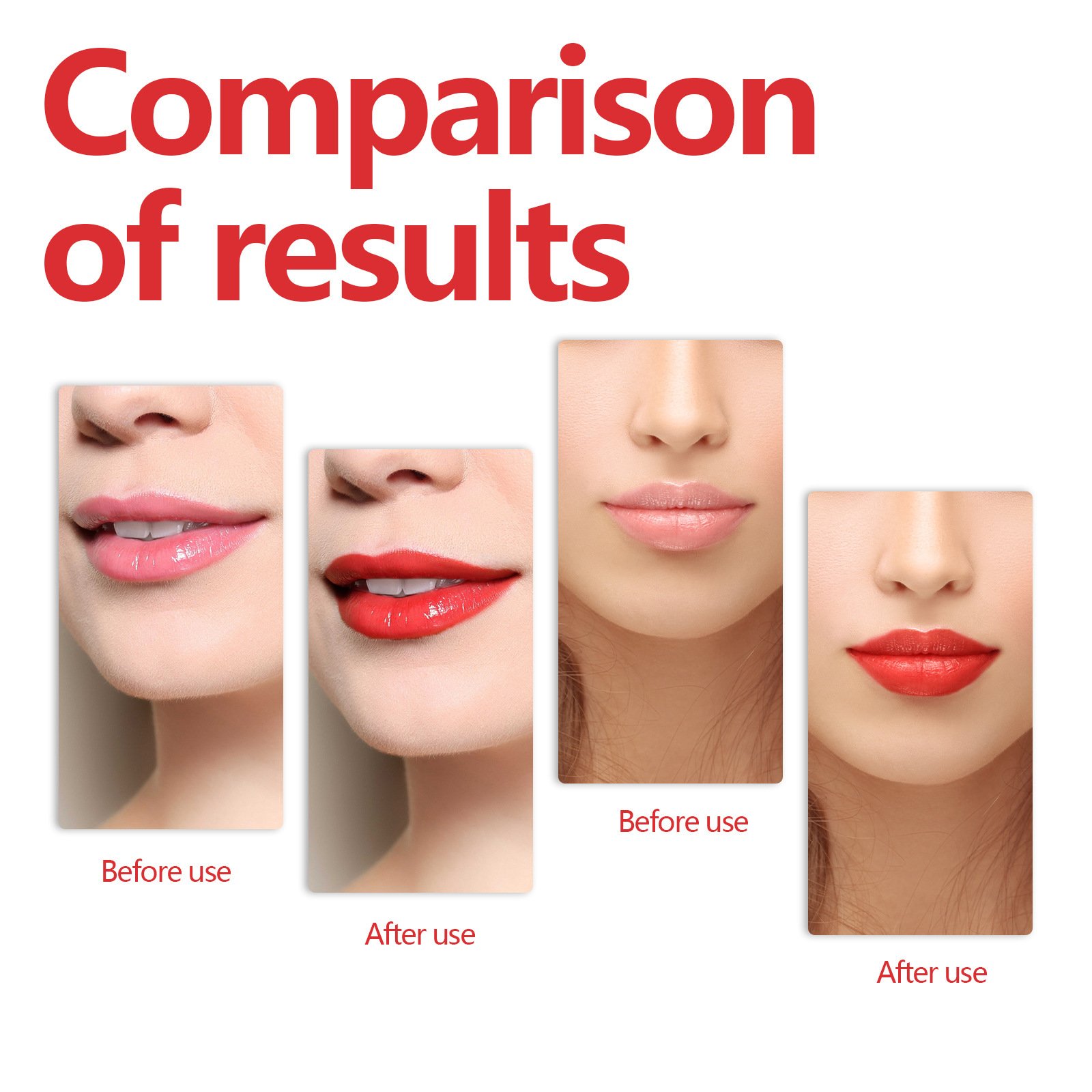 Fade Lip Lines - Product Image 8
